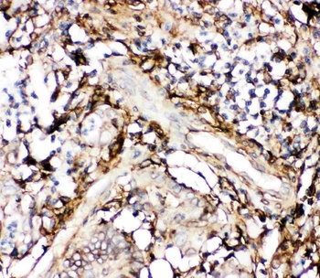 Annexin V/ANXA5 Rabbit Polyclonal Antibody