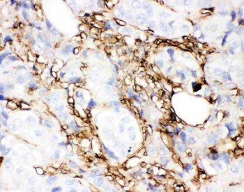 Annexin V/ANXA5 Rabbit Polyclonal Antibody