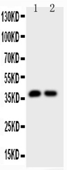 Calbindin/CALB1 Rabbit Polyclonal Antibody