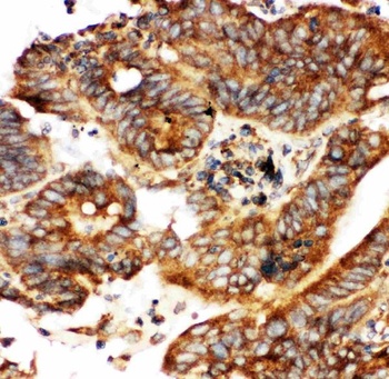 Calbindin/CALB1 Rabbit Polyclonal Antibody