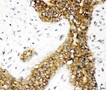 Calbindin/CALB1 Rabbit Polyclonal Antibody