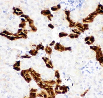 Calbindin/CALB1 Rabbit Polyclonal Antibody