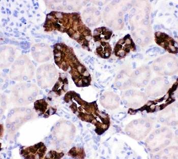 Calbindin/CALB1 Rabbit Polyclonal Antibody