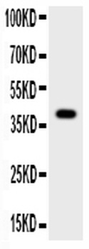 Cathepsin B/CTSB Rabbit Polyclonal Antibody