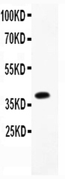 Cathepsin D/CTSD Rabbit Polyclonal Antibody