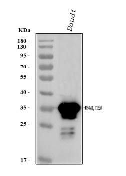CD20/MS4A1 Rabbit Polyclonal Antibody