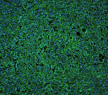 CD20/MS4A1 Rabbit Polyclonal Antibody