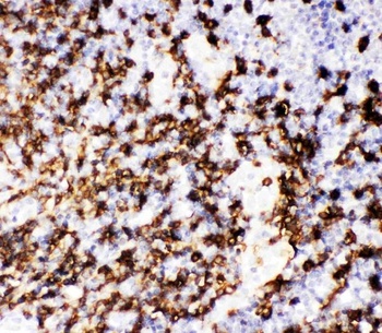 CD20/MS4A1 Rabbit Polyclonal Antibody