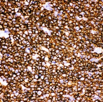CD20/MS4A1 Rabbit Polyclonal Antibody