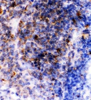 CD23/FCER2 Rabbit Polyclonal Antibody