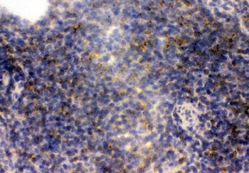 CD23/FCER2 Rabbit Polyclonal Antibody