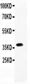 CD23/FCER2 Rabbit Polyclonal Antibody