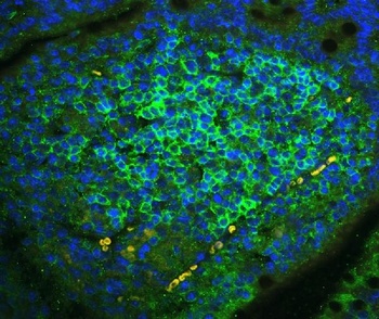 CD23/FCER2 Rabbit Polyclonal Antibody