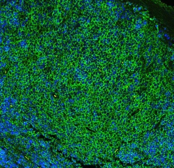 CD23/FCER2 Rabbit Polyclonal Antibody