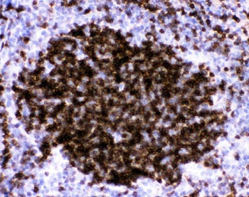 CD23/FCER2 Rabbit Polyclonal Antibody
