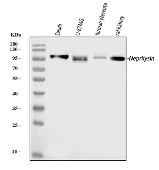 CD10/MME Rabbit Polyclonal Antibody