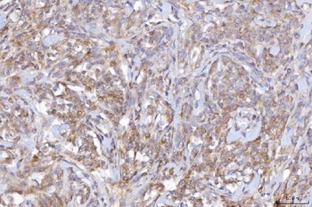 CD10/MME Rabbit Polyclonal Antibody