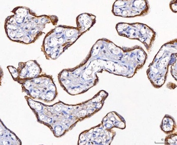 CD10/MME Rabbit Polyclonal Antibody