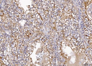 CD10/MME Rabbit Polyclonal Antibody