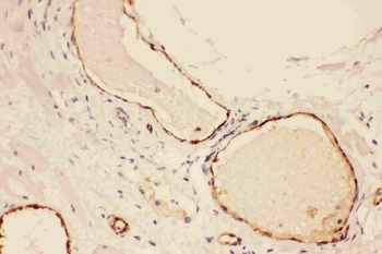 Von Willebrand Factor/VWF Rabbit Polyclonal Antibody