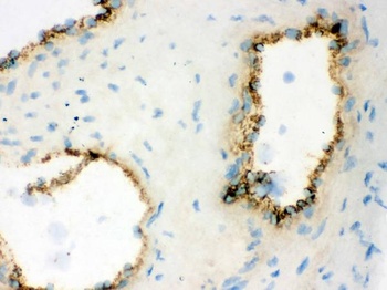 Von Willebrand Factor/VWF Rabbit Polyclonal Antibody