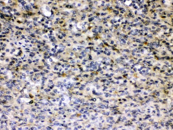 Hepatitis B Virus Rabbit Polyclonal Antibody