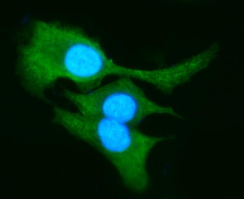 AKR1B10 Rabbit Polyclonal Antibody