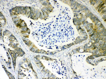 AKR1B10 Rabbit Polyclonal Antibody