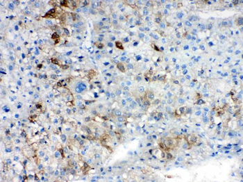 AKR1B10 Rabbit Polyclonal Antibody