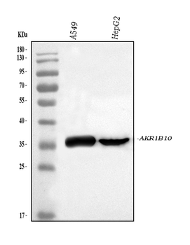 AKR1B10 Rabbit Polyclonal Antibody