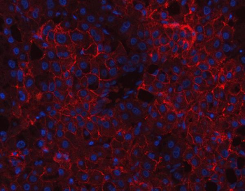 CD166/ALCAM Rabbit Polyclonal Antibody