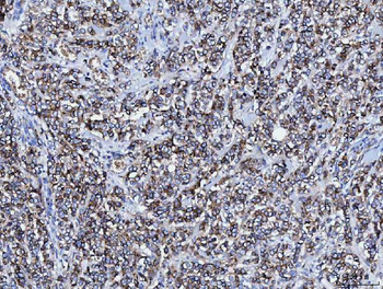 CD166/ALCAM Rabbit Polyclonal Antibody