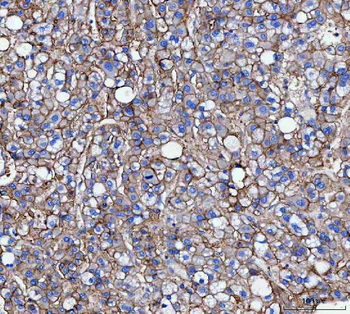 CD166/ALCAM Rabbit Polyclonal Antibody
