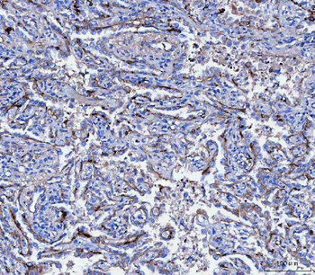CD166/ALCAM Rabbit Polyclonal Antibody
