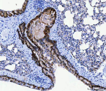 CD166/ALCAM Rabbit Polyclonal Antibody