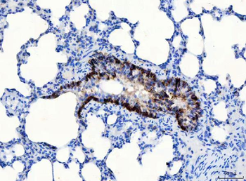 CD166/ALCAM Rabbit Polyclonal Antibody