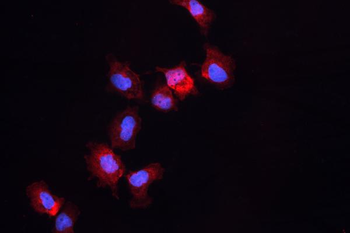 ALDH1A3 Rabbit Polyclonal Antibody