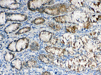 ALDH1A3 Rabbit Polyclonal Antibody