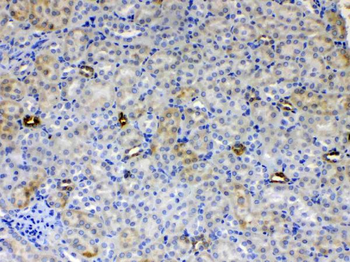 ALDH1A3 Rabbit Polyclonal Antibody
