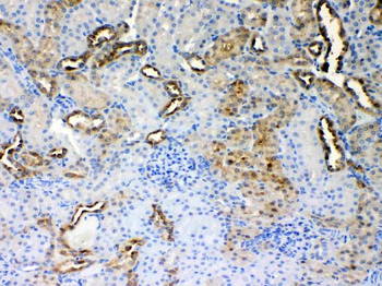 ALDH1A3 Rabbit Polyclonal Antibody