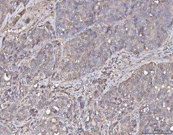 Annexin IV/ANXA4 Rabbit Polyclonal Antibody