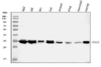 Annexin IV/ANXA4 Rabbit Polyclonal Antibody