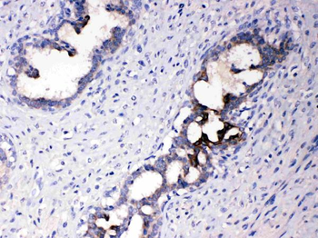 ATF6 Rabbit Polyclonal Antibody