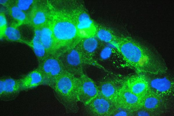 Beta 2 Microglobulin/B2M Rabbit Polyclonal Antibody