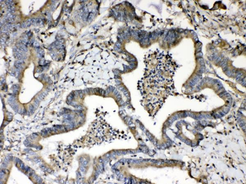 Beta 2 Microglobulin/B2M Rabbit Polyclonal Antibody