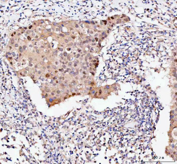 Bag1 Rabbit Polyclonal Antibody