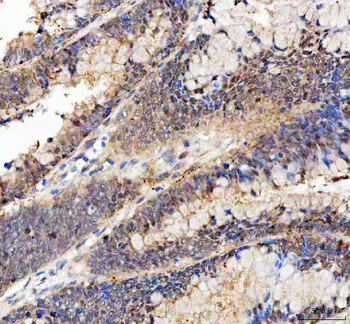 Bag1 Rabbit Polyclonal Antibody