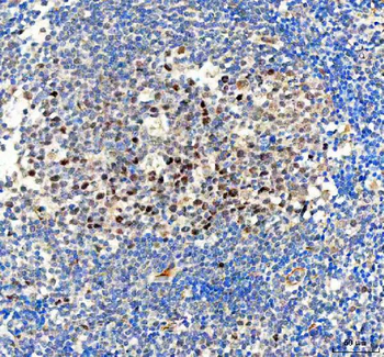 Bag1 Rabbit Polyclonal Antibody