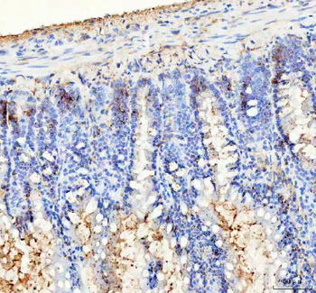 Bag1 Rabbit Polyclonal Antibody