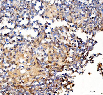 Survivin/BIRC5 Rabbit Polyclonal Antibody